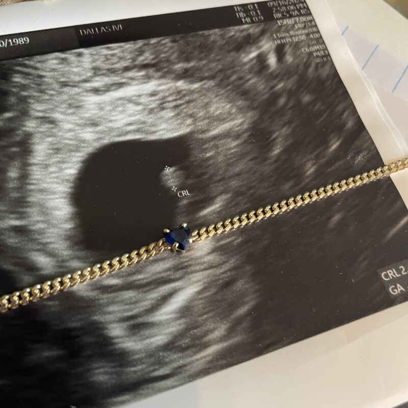 Brittany’s memorial bracelet on her scan Brittany’s memorial bracelet on her scan